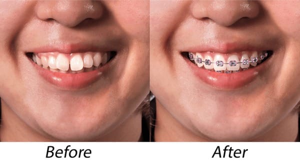 Orthodontie